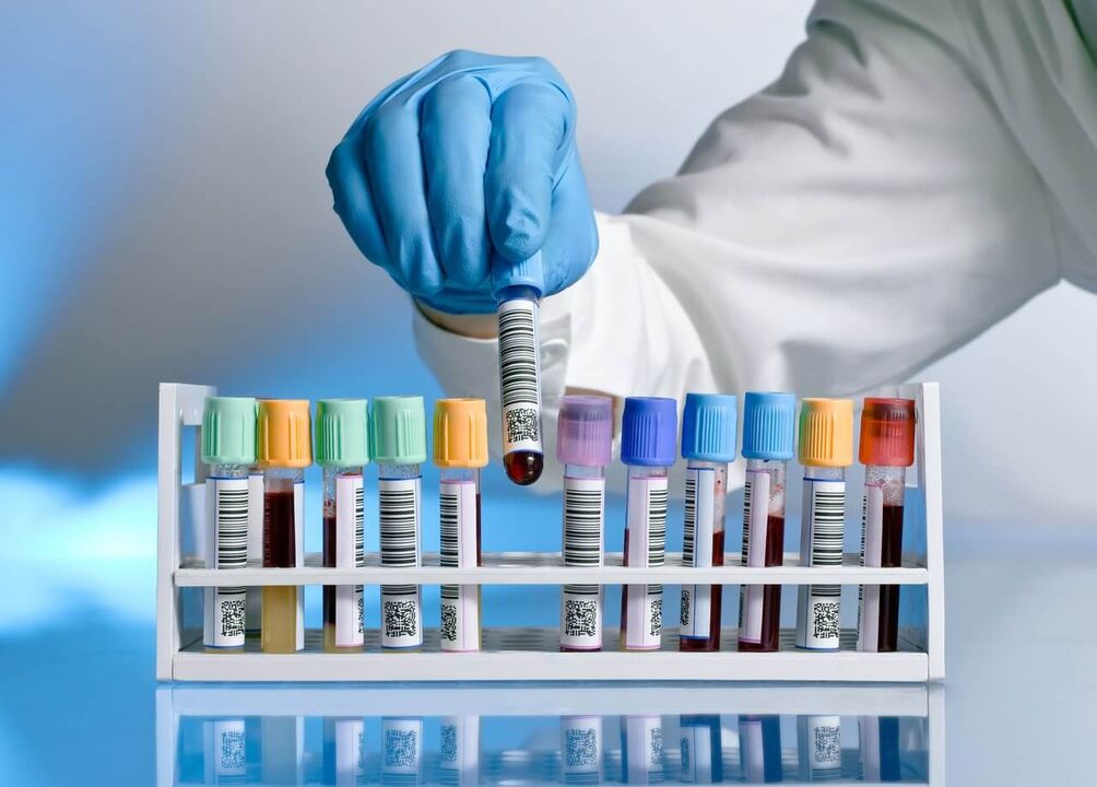 Tests sanguins pour les sécrétions pathologiques au réveil