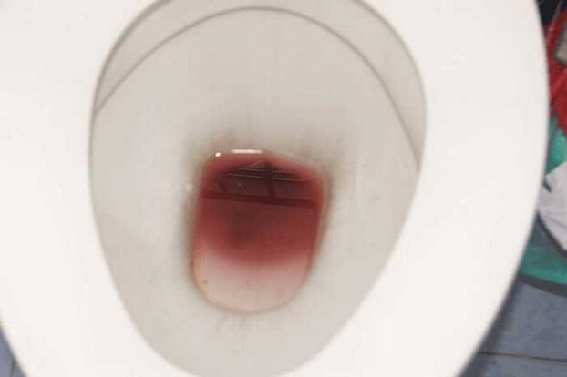 Des taches apparaissent lorsque les hommes sont excités